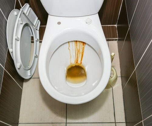 Preventing Rust Stains In Your Toilet Bowl