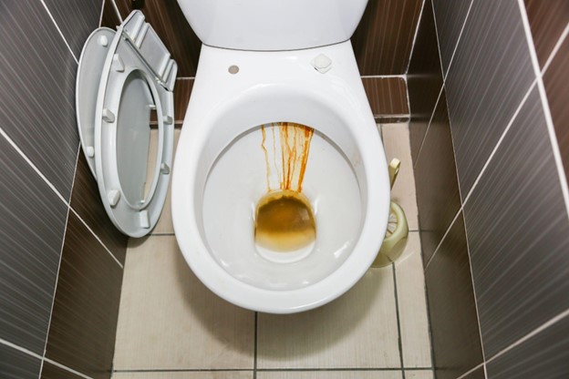 Preventing Rust Stains In Your Toilet Bowl